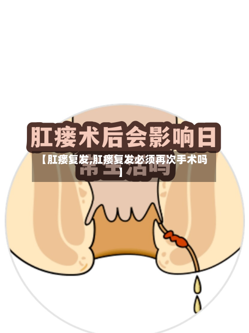 【肛瘘复发,肛瘘复发必须再次手术吗】