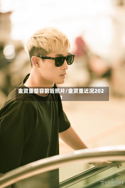 金贤重整容前后照片/金贤重近况2021-第2张图片